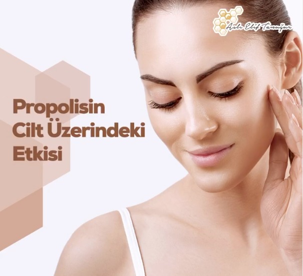 propolisin_sedef_egzema_uzerine_etkisi