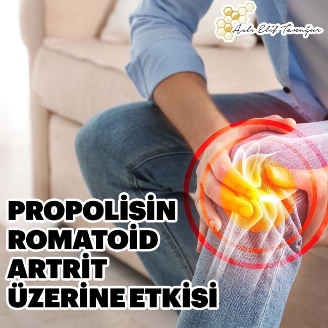 propolisin-romatoid-artrit-etkisi