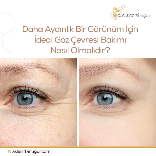 goz-cevresi-bakimi-nasil-olmali