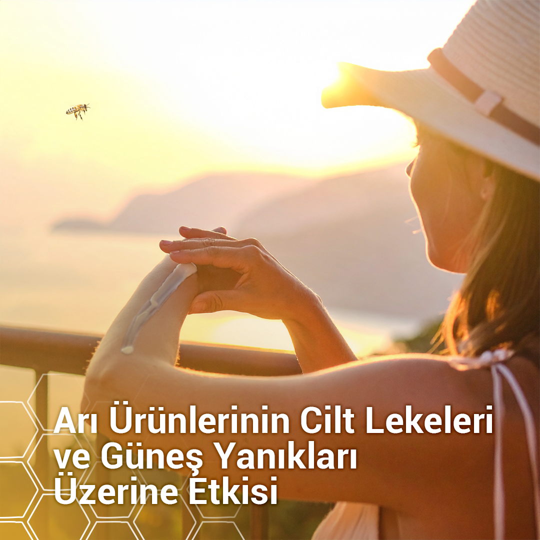 Güneş Yanıkları ve Cilt Lekeleri: Arı Ürünleriyle Doğal Bakım